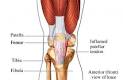 Patellar <b>Tendinopathy</b> - What Is It, Symptoms, Causes | Lifescript.