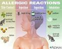 Allergic Reactions - Wake Forest Baptist Medical Center