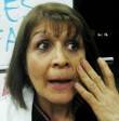 Mrs. Clara Martinez was surprised after the wart had disappeared in a few ... - clara_martinez