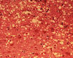 Bovine spongiform encephalopathy - Wikipedia, the free encyclopedia