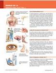 <b>Diabetes Mellitus Tipo 2</b>