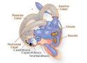 BPPV -- BENIGN PAROXYSMAL POSITIONAL VERTIGO