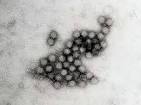 NOROVIRUS infection