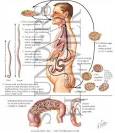 Ascariasis