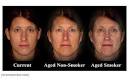 How smoking accelerates the aging process