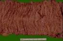 <b>adenomatous polyposis coli</b>