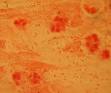 Haemophilus influenzae - Wikipedia, the free encyclopedia