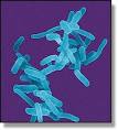 Shigella can be spread from person to person, or from persons to ...