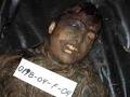 "GIVE 'White Phosphorous' A 'JEWISH'-AMERICAN-NICK-NAME: 'Willie-Pete' UNT ... - IraqiBurnedFEMALEVICTIMOFUS