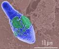 Clostridium Botulinum | Humen Healths