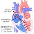 Categories of Arrhythmias - Texas Heart Institute Heart ...