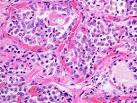 Thyroid gland
