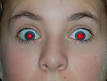 Red-eye effect