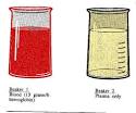 blood gases anion gap delta gap bicarbonate gap serum