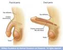 What does Sexual Dysfunction look like?