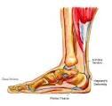 Achilles Tendonitis Overview - Achilles Tendonitis ...