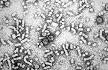 of <b>hepatitis B</b> virus