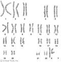 Karyotyping | LaraSig