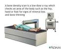 Bone density scan -