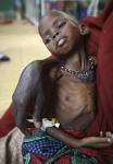 Millions of Malnourished Children in Horn of Africa are at Risk of ...