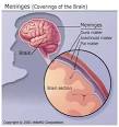 What Is Meningitis? Bacterial, Viral, and Fungal Meningitis Causes