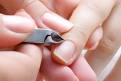 Discovery Health "Why are my cuticles and nails separating?"