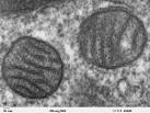 File:Mitochondria, mammalian lung - TEM.jpg - Wikimedia Commons