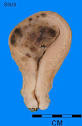 Museum of Pathology