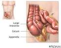Appendix -