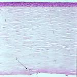 The <b>corneal stroma</b> shows