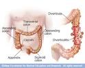 Mayo Clinic medical information and tools for healthy living ...