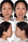 patient: note the facial