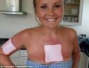 an allergic reaction to