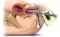 Your Health -