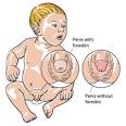  Circumcision 