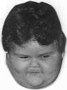 of excess fat in the face: