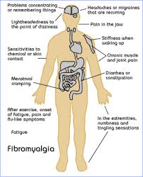  Yoga and Fibromyalgia