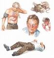 How Long Will Your Alcohol Withdrawal Symptoms Last? — DrugRehabMe.