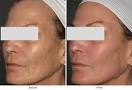Actual results of Dr. Janee