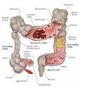 Colonic, Colon Hydro Therapy sessions for constipation, IBS, Bloat ...