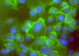 un virus giustiziere derivato dal vaiolo potrà combattere i tumori per endovena
