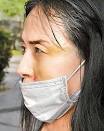 許純美雖戴口罩遮掩，仍見大片瘀