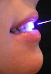 In dentistry, especially the blue laser is very important for the direct ... - Zahn