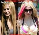Lavigne, Avril - Make Me Heal