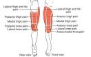 hip, <b>thigh</b>, knee trigger point