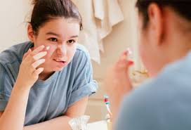 Natural Treatments for Zits