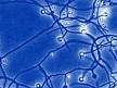 A symbiotic nitrogen-fixing actinobacterium - Site du Genoscope