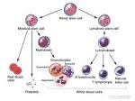 Chronic Lymphocytic Leukemia Treatment (PDQ®) - The University of ...
