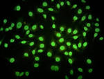 File:IFI-Nuclear and inespecific citoplasmatic stain Hep-2 Line ...
