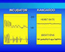 la <b>temperatura cutánea</b> del